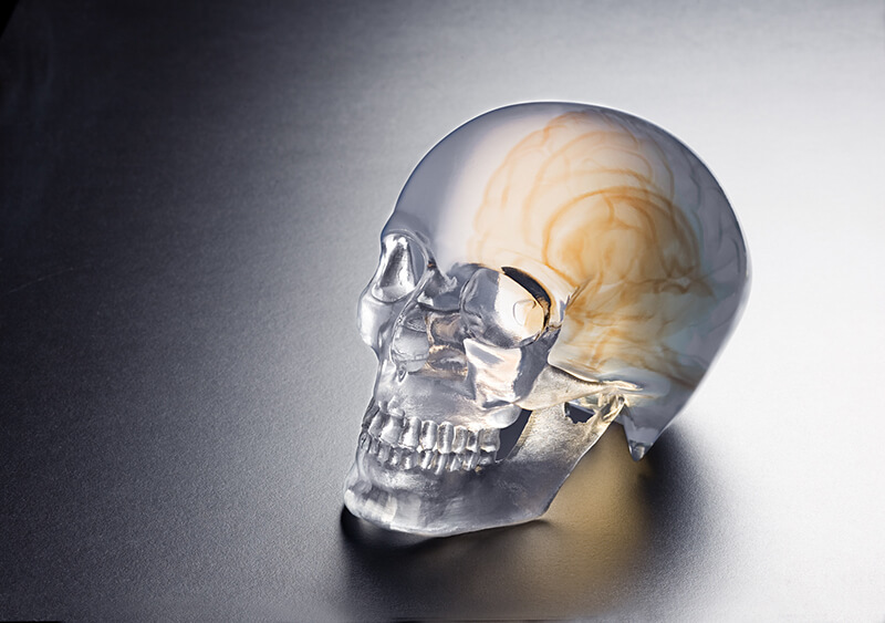 Orthopedics_Skull Model 1a 2.jpg